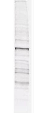 Phosphothreonine Antibody in Western Blot (WB)