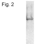 ATP Synthase beta Antibody in Western Blot (WB)