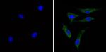 Recoverin Antibody in Immunocytochemistry (ICC/IF)