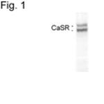 Calcium Sensing Receptor Antibody in Western Blot (WB)