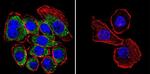 CFTR Antibody in Immunocytochemistry (ICC/IF)