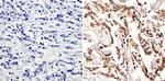 c-Myc Antibody in Immunohistochemistry (Paraffin) (IHC (P))