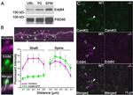 CaMKII alpha Antibody in Immunohistochemistry (IHC)