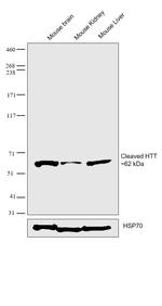 Huntingtin Antibody