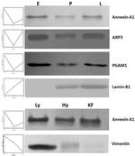 Lamin B1 Antibody in Western Blot (WB)