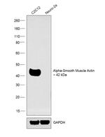 Alpha-Smooth Muscle Actin Antibody