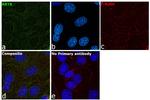 Cytokeratin 8 Antibody in Immunocytochemistry (ICC/IF)