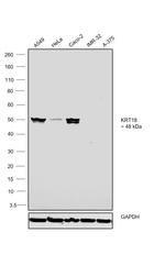 Cytokeratin 18 Antibody in Western Blot (WB)