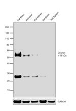 Desmin Antibody in Western Blot (WB)