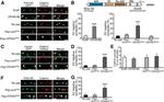 Clathrin Heavy Chain Antibody in Immunocytochemistry (ICC/IF)