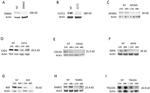 Clathrin Heavy Chain Antibody in Western Blot (WB)