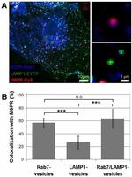 IGF2R Antibody in Immunocytochemistry (ICC/IF)