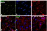 IGF2R Antibody