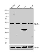 NUP62 Antibody in Western Blot (WB)