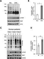 O-linked N-acetylglucosamine (O-GlcNAc) Antibody in Western Blot (WB)