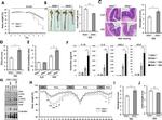 O-linked N-acetylglucosamine (O-GlcNAc) Antibody in Western Blot (WB)