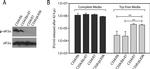 EIF2S1 Antibody in Western Blot (WB)