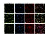 NUP107 Antibody in Immunocytochemistry (ICC/IF)