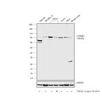 beta Catenin Antibody in Western Blot (WB)