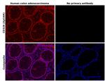 EpCAM Antibody in Immunohistochemistry (Paraffin) (IHC (P))