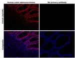 EpCAM Antibody in Immunohistochemistry (Paraffin) (IHC (P))