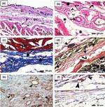 CD34 Antibody in Immunohistochemistry (IHC)