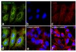 Cytokeratin 18 Antibody in Immunocytochemistry (ICC/IF)