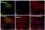 SOD2 Antibody