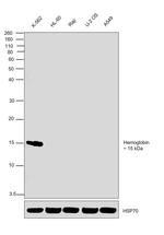 Hemoglobin Antibody in Western Blot (WB)