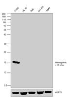 Hemoglobin Antibody in Western Blot (WB)