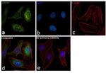 HSP90 alpha Antibody in Immunocytochemistry (ICC/IF)