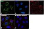 Cytokeratin 7 Antibody in Immunocytochemistry (ICC/IF)