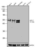 Cytokeratin 7 Antibody in Western Blot (WB)