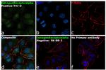 Estrogen Receptor alpha Antibody