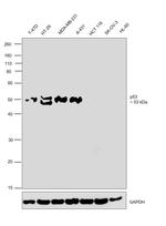 p53 Antibody in Western Blot (WB)