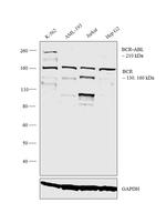 BCR-ABL Antibody in Western Blot (WB)