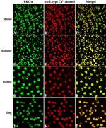 PKC alpha Antibody in Immunohistochemistry (IHC)