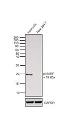 p19ARF Antibody in Western Blot (WB)