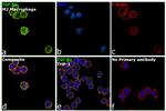 TGF beta-1 Antibody