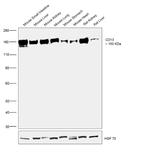 CD13 Antibody in Western Blot (WB)