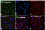 Cytokeratin 18 Antibody