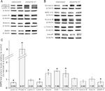 beta-3 Tubulin Antibody in Western Blot (WB)