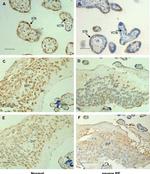 HLA-G Antibody in Immunohistochemistry (IHC)