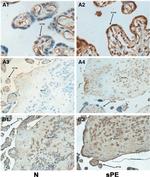 HLA-G Antibody in Immunohistochemistry (IHC)