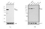 NEFM Antibody in Western Blot (WB)