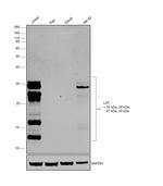 LAT Antibody in Western Blot (WB)