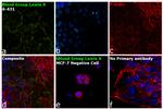 Blood Group Lewis A Antibody