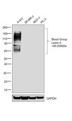 Blood Group Lewis A Antibody