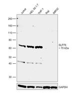 SLP76 Antibody in Western Blot (WB)