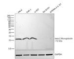 beta-2 Microglobulin Antibody